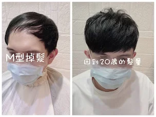 補髮際線